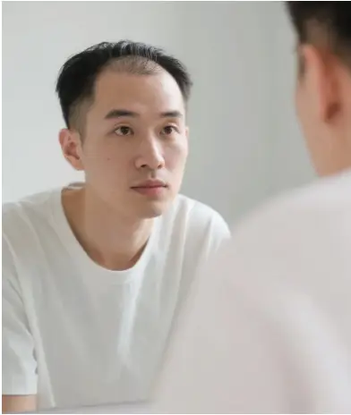 发量变化人群