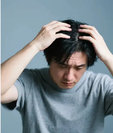 头皮状态困扰